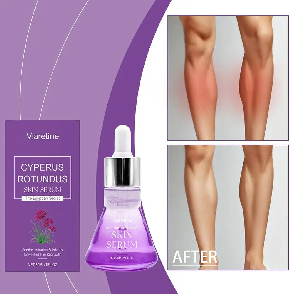 Post Hair Removal Care Serum Soothing Brightening Skin Care for Keeping It Moisturized Soft Refreshed with Hyaluronic