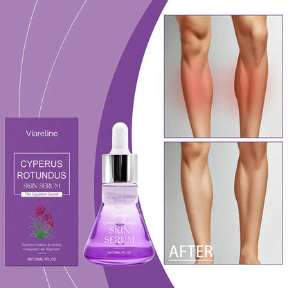 Post Hair Removal Care Serum Soothing Brightening Skin Care for Keeping It Moisturized Soft Refreshed with Hyaluronic